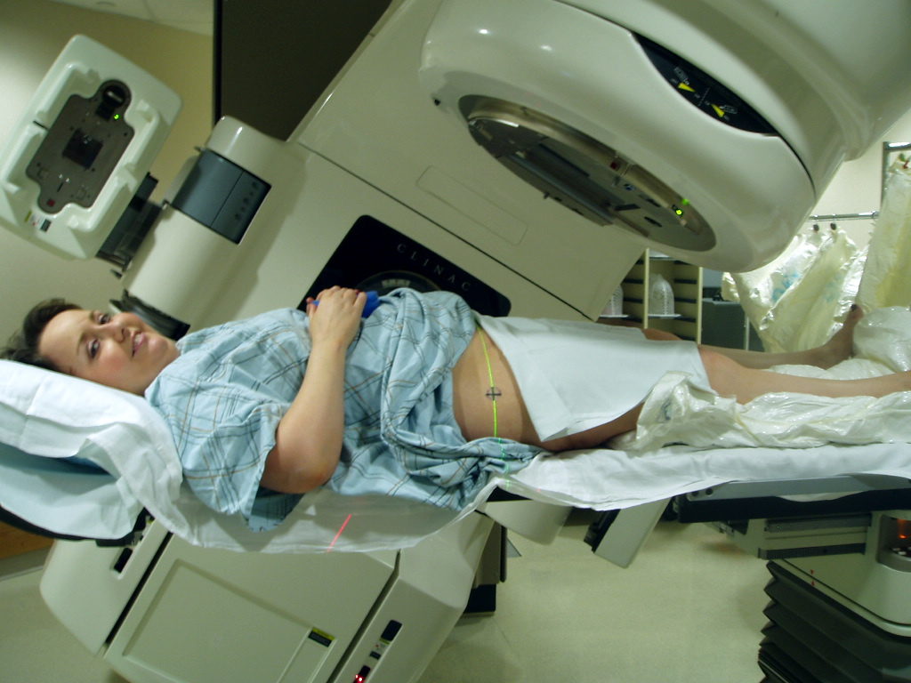 radiation therapy in cancer cervix